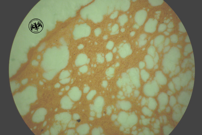 Matrix Variscit