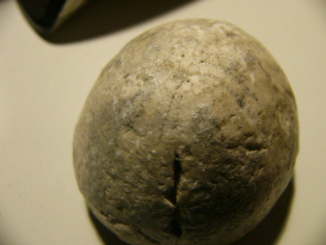 Seeigel